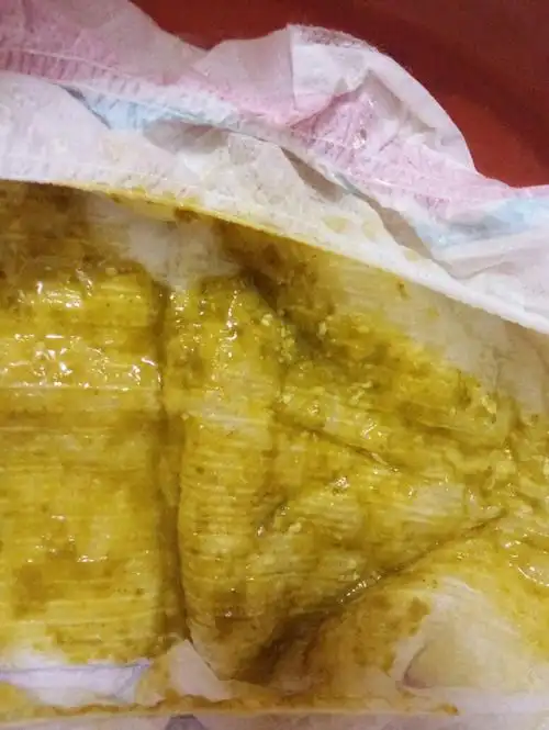 屎里面好像还有白的东西这是拉屎的图片请问一下有谁懂这些.