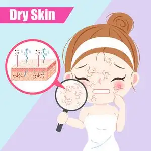 干性皮肤在蓝色背景上的女人卡通女人与皮肤干燥皮肤干燥的女人干性