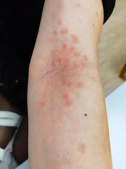 "中午十二点,宁波大学医学院附属医院皮肤整形修复中心袁波副主任医师