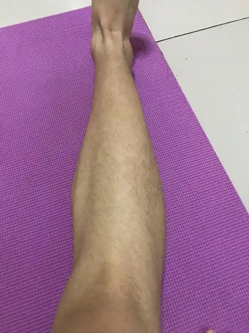 本人原先超级胖有二百多斤,现在瘦了点,身高186,78公斤,感觉小腿好粗