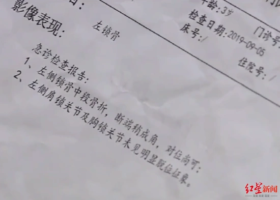 小孩骨折诊断报告