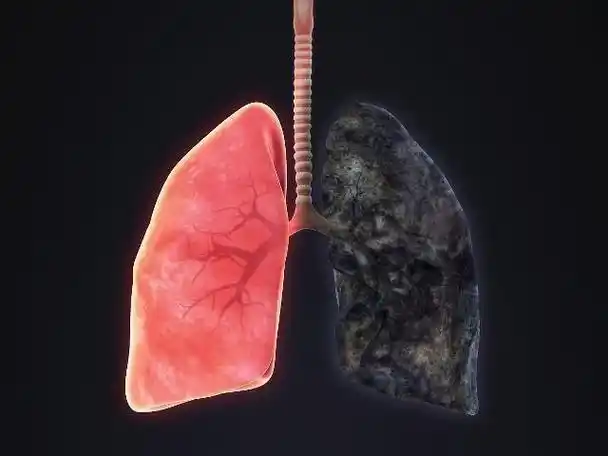 长期吸烟肺不好此物多吃点帮你的肺洗洗澡
