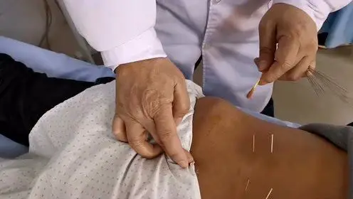 腰腿痛很多是腰椎间盘突出引起,专家教你如何针灸治疗