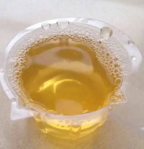 早起后排尿是大多数人的习惯之一,而身体正常的情况下尿液为淡黄色