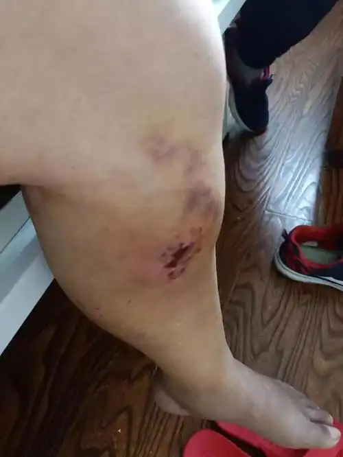 七旬老人在养老院被棍子打 院长:不是针对她,所有的老人我都打--幸福