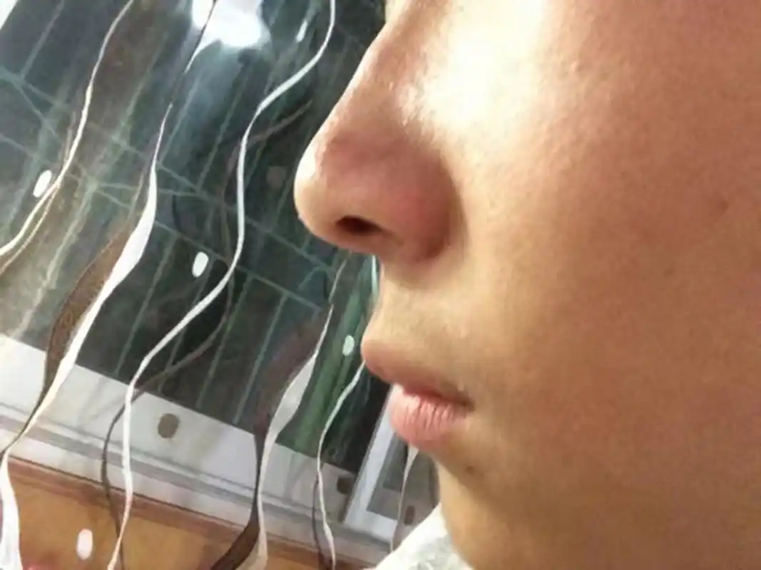 1,朝天鼻 正面看,鼻孔朝天,侧面看鼻尖朝天,类似猪猪鼻 2,驼峰鼻