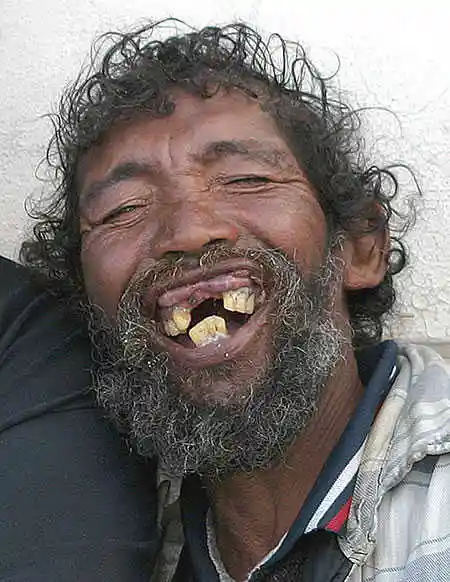 人是因为丑而不会搭配衣服还是因为不会搭配衣服而丑?