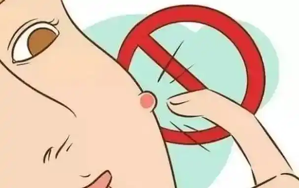 张疖子怎么办 长疖子怎么消肿