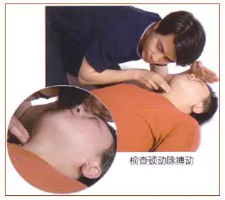 成人应触诊颈动脉,方法:用示指,中指指腹触及喉结,然后向外侧轻轻滑动