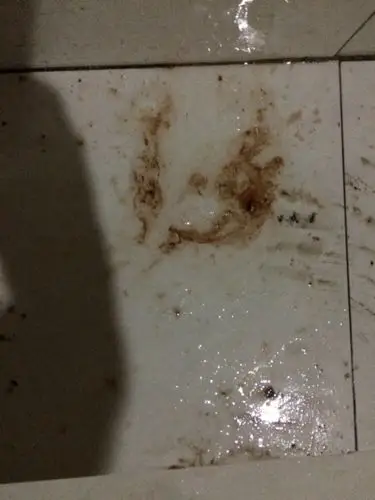 反胃酸,打嗝.烧心.今天吐出来了舒服一点,但是颜色暗红.先问问是