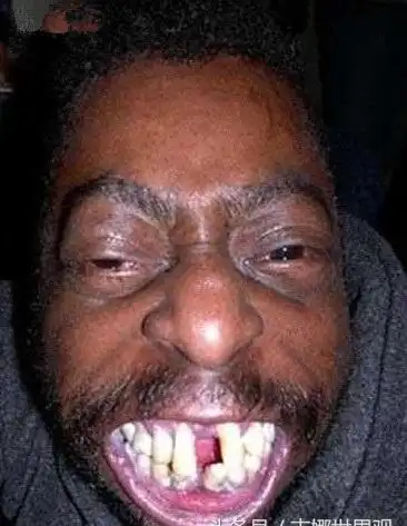 网络十大丑男照片(直击全球最丑10大男性,7个非洲,1个印度,竟然全都有