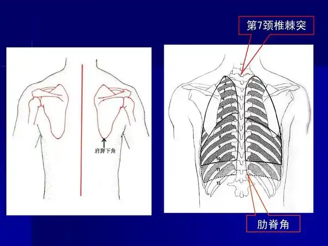 第7颈椎棘突 肋脊角