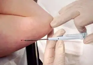 皮埋植入的避孕针多久起效 皮下埋植避孕针起效时间