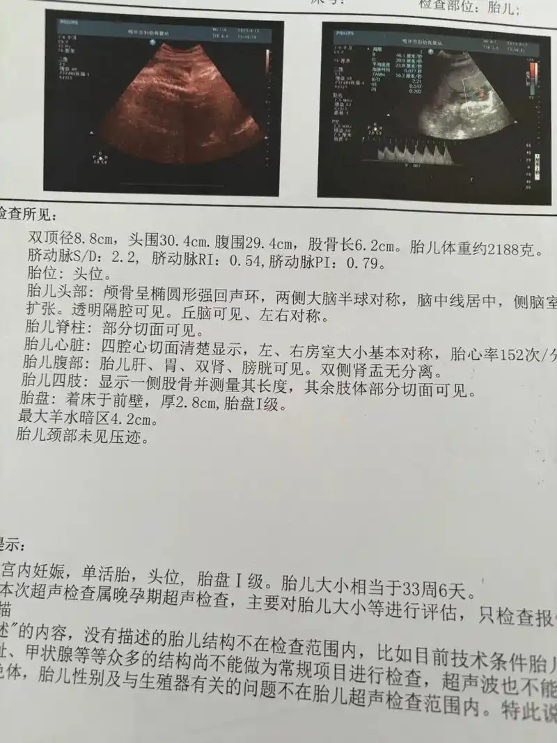 6.6斤的男宝宝,想要男宝的快来接吧,分享一下我儿 - 抖音