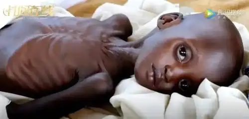 南苏丹地区,孩子们不知有多久没吃上饭,瘦得皮包骨头.