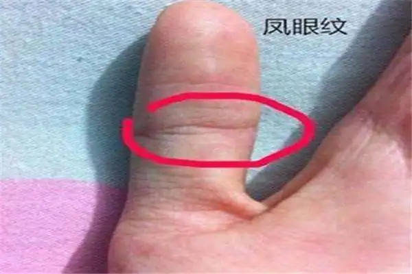 有凤眼纹的女人命苦吗 不会,凤眼纹是吉祥的征兆