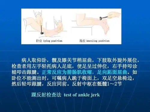 神经系统检查ppt