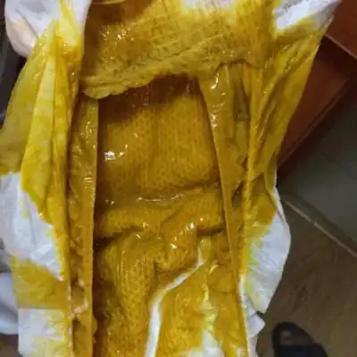 频繁的拉小屎,近期做推拿,昨天九点大便三次,量也不少,凌晨两点又