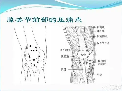 我们先看膝关节前方的压痛