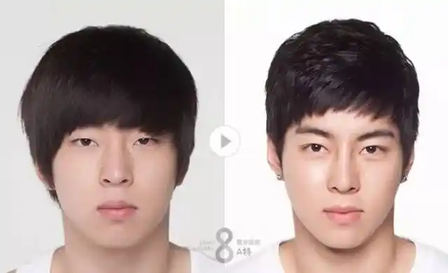 惊艳到爆!男士整容前后对比照片