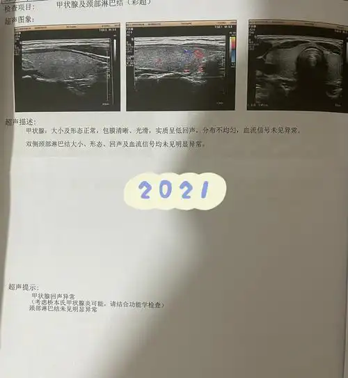 外科检查医生让咽口水,触诊说甲状腺可能有结节,体检完去做彩超看一下