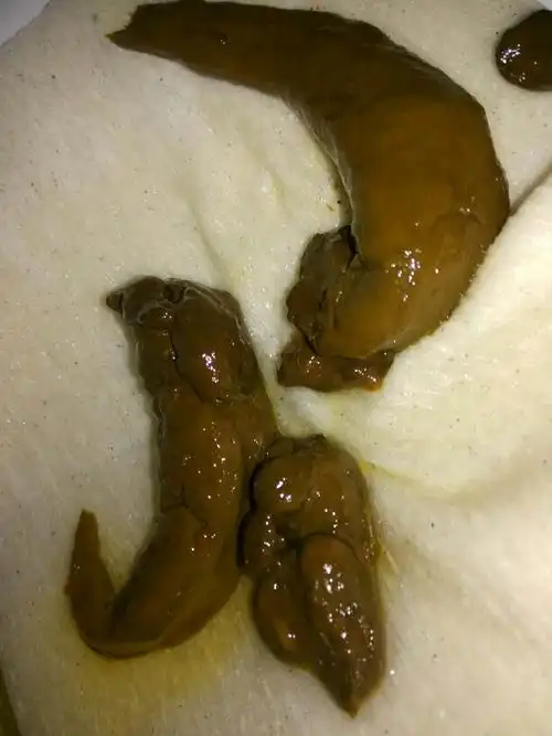 这样大便形状正常吗?有没有医生呢