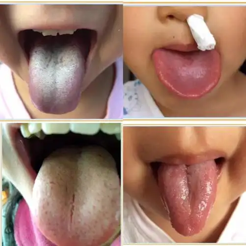 母婴,宝宝喂养,育儿知识,新生儿,产后护理