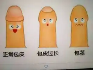 卫你说事关于宝宝小鸡鸡的那些大事