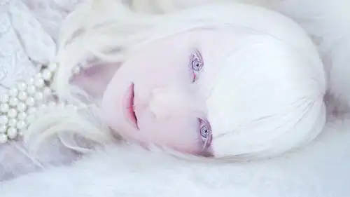 得了白化病怎么办?不妨了解下白化病基因检测——佳学基因