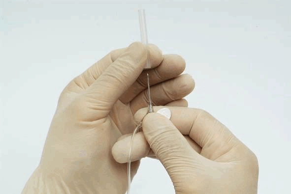 及拔管图解流程洗手,戴口罩准备用物健康宣教,核对评估血管固定输液架