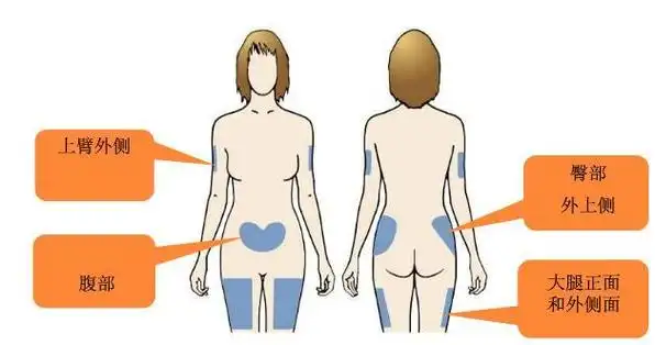 注射部位