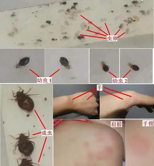 臭虫怕什么,如何消灭臭虫的最有效方法,臭虫哪里来的?图14