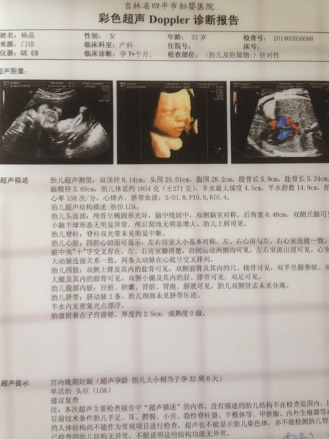 32周四维彩超终于看到宝宝的照片了