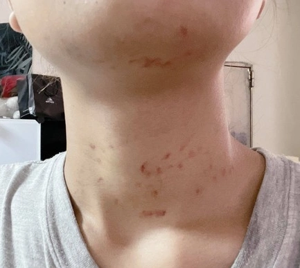 主人晒出满脖子的草莓印,猫:对,她男朋友就是我!