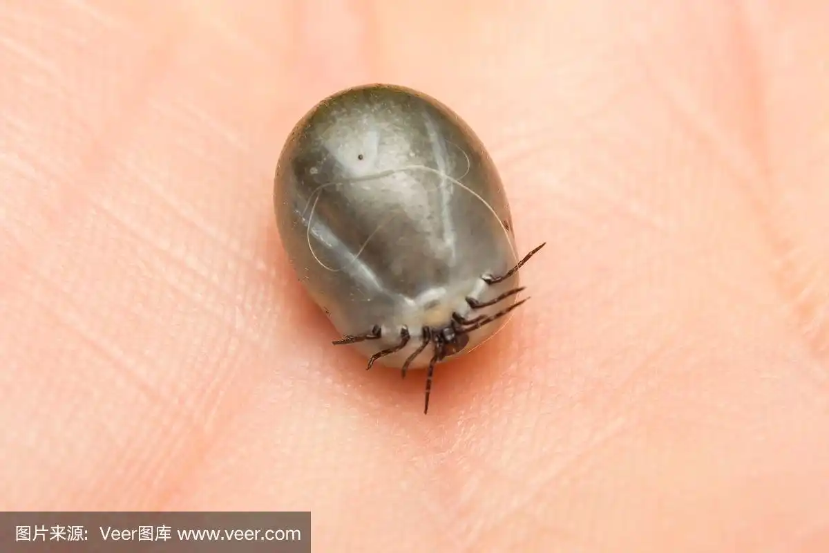 人类皮肤上的蜱虫特写照片