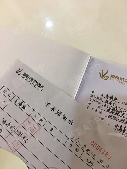 长沙嘉悦莱肉毒素瘦脸针手术当天