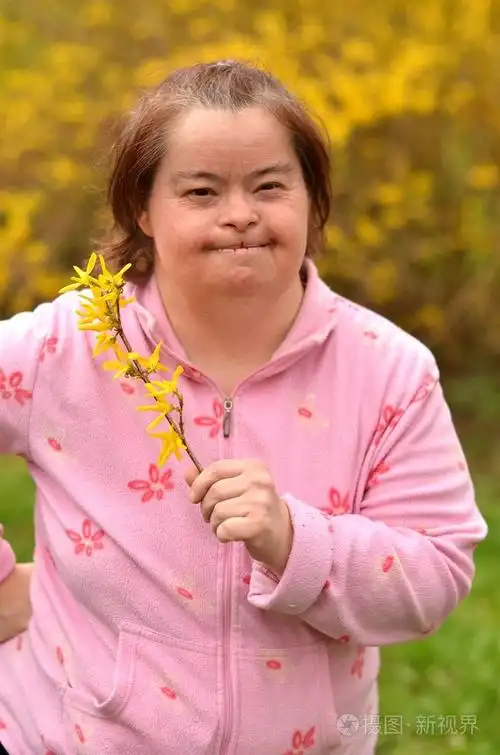 唐氏综合征的女人