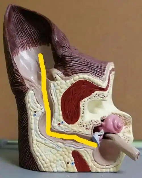 洗耳恭听,别再用棉签给狗狗掏耳朵啦!你那叫瞎捅!