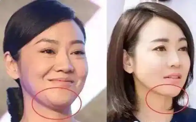 46岁闫妮不会保养再年轻都没用