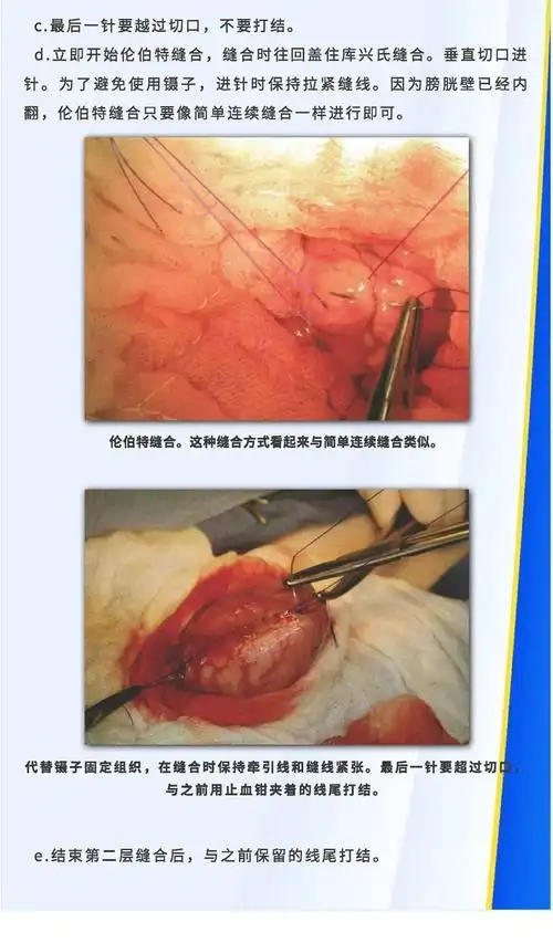 【图解】膀胱切开术,收藏转发防丢失_手机搜狐网