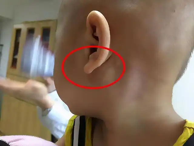 宝宝有这5个特征,说明将来很有"福气",对照看你家娃占几个?