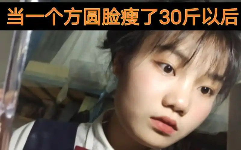 方圆脸瘦了30斤会凹陷吗?