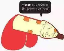 宝宝龟头发炎能用红霉素眼膏吗_两岁宝宝龟头发炎_两个月的宝宝龟头