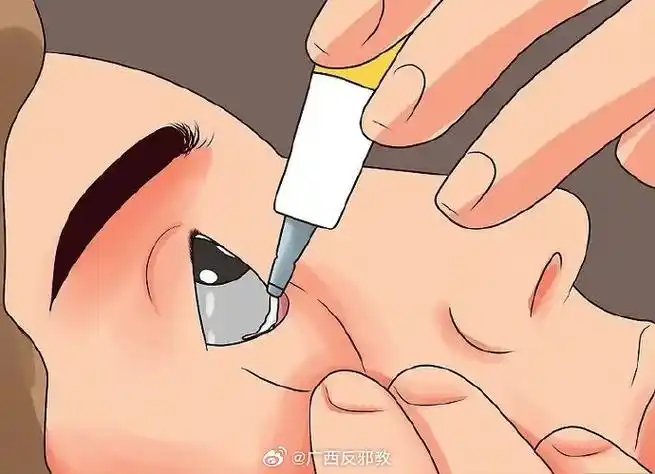 红霉素软膏和红霉素眼膏什么区别