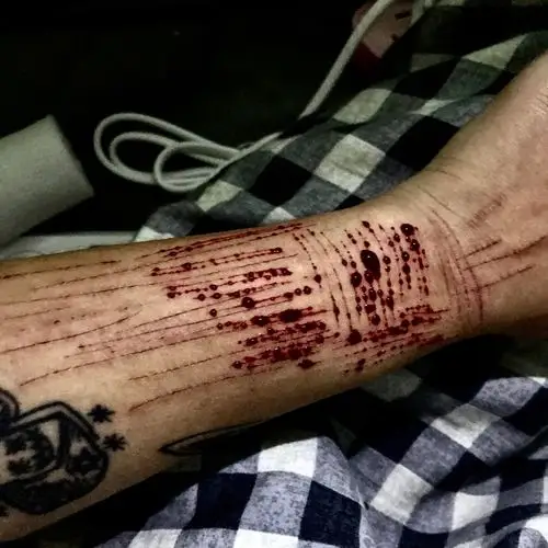 太令人讨厌了.在前任那尝到了自残的甜头,从此一发不可收拾.