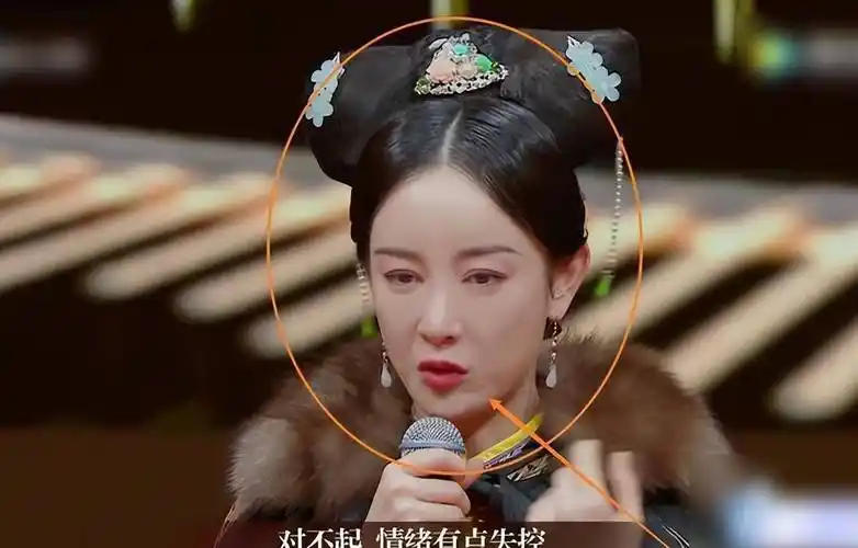 "为爱整容"的张檬,整容前后判若两人,脸部僵硬,塑料感满满_自然_面部