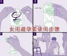 女用避孕套