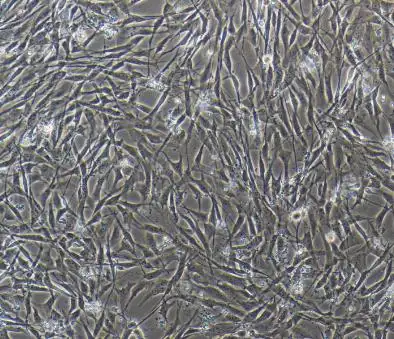 人Ⅱ型肺泡上皮细胞