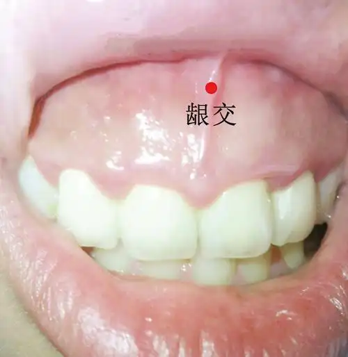 龈交穴准确位置视频图作用功效配穴方法