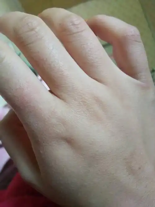 手痒死了,出来的这都什么啊